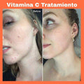 Ampollas sérum 20 días Vitamina C