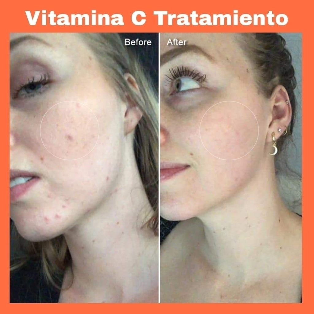 Ampollas sérum 20 días Vitamina C