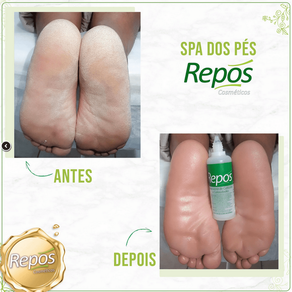 Repos cutículas y callos