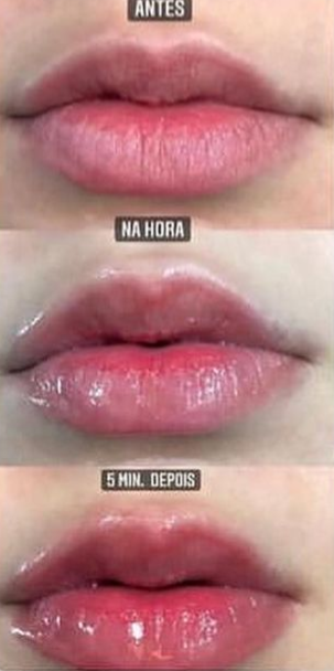 Big Mouth Phallebeauty