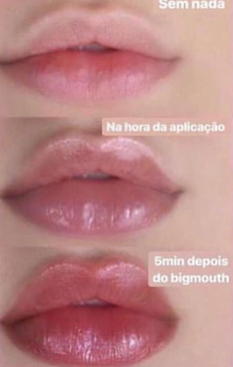 Big Mouth Phallebeauty